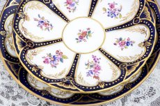 時計で言うと2時半か、3時ごろの部分に金彩のロスが見えます。